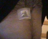 (Bandage)