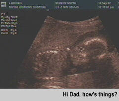 [Bowen the Younger - ultrasound]